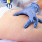 8c0b8cac-ddbd-4909-81bb-d623b6efc898 (2) 8c0b8cac-ddbd-4909-81bb-d623b6efc898 (2)