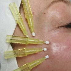 b2d98224-395d-420d-8694-b42e20d1e02e b2d98224-395d-420d-8694-b42e20d1e02e